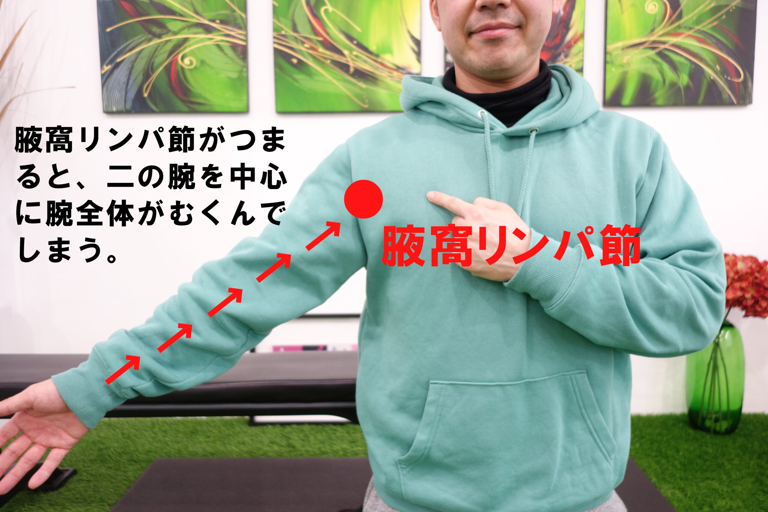 腋窩リンパ節の位置を表示