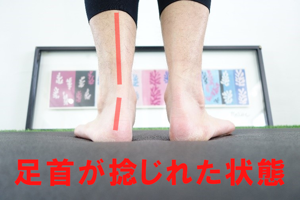 足首が捻じれた状態