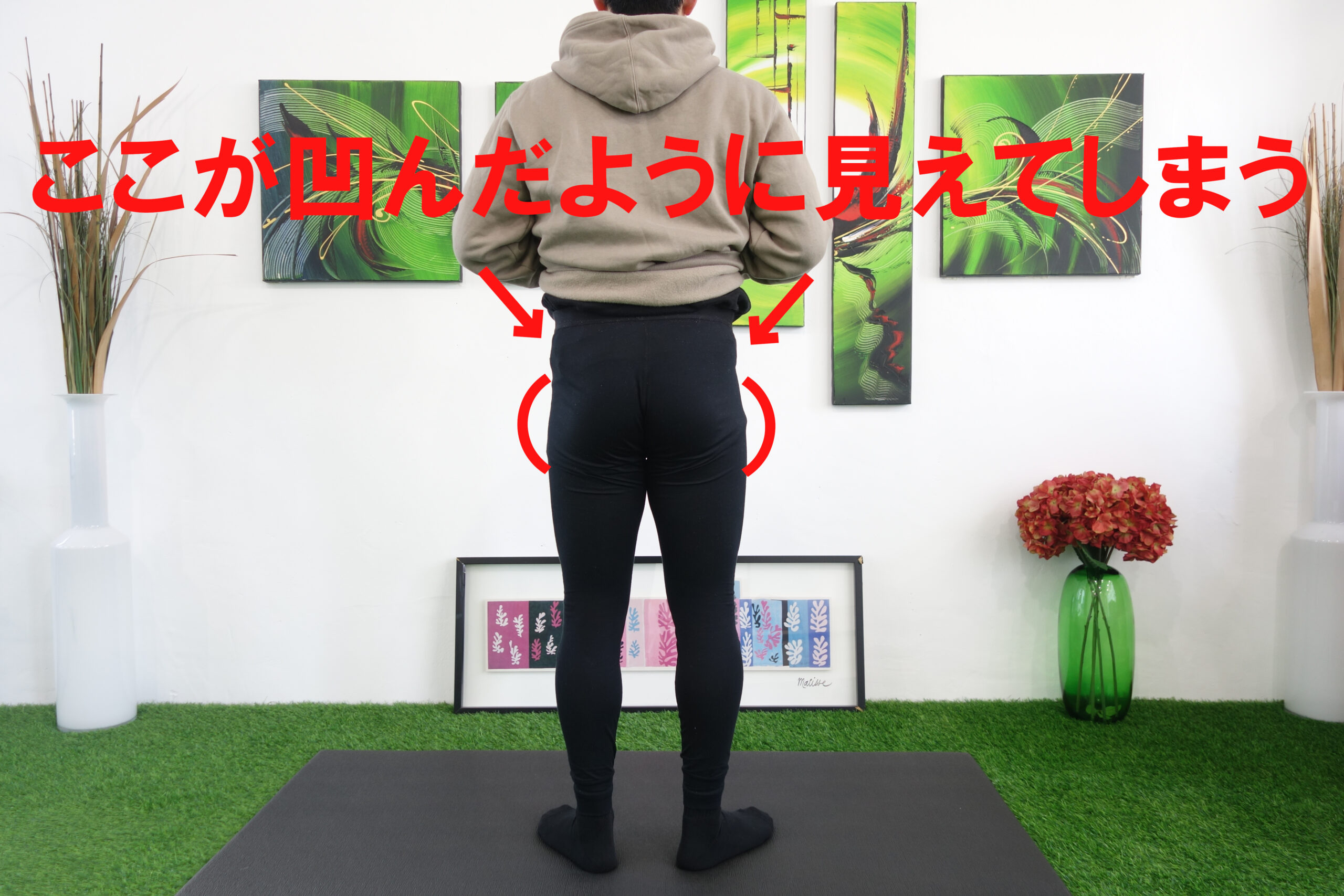 お尻の凹み
